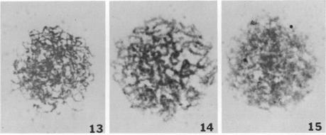 Fig. 13-15