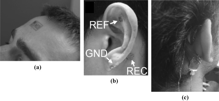 Fig. 11