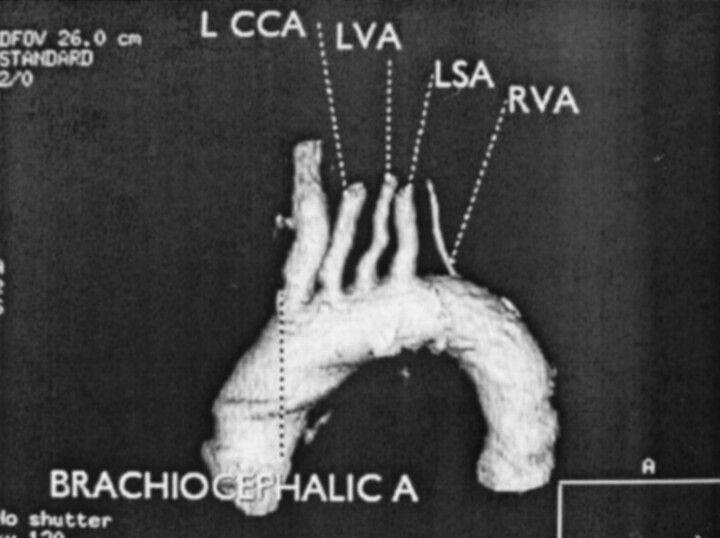 Fig 1.