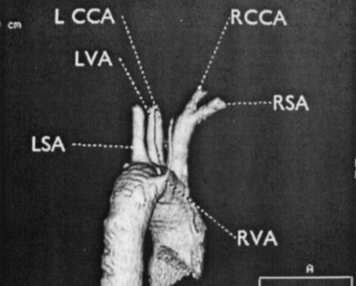 Fig 2.