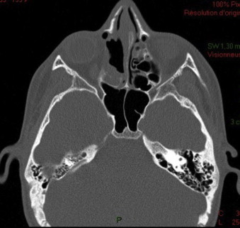 Fig. 9