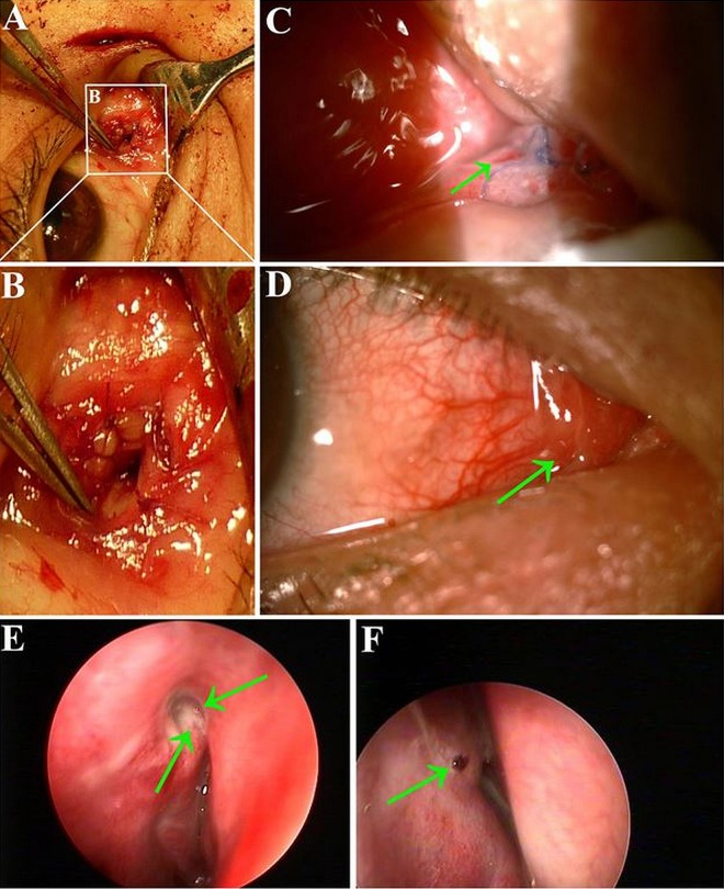 Figure 3