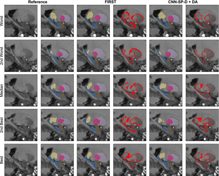 Figure 11