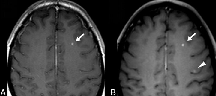 Fig 2.