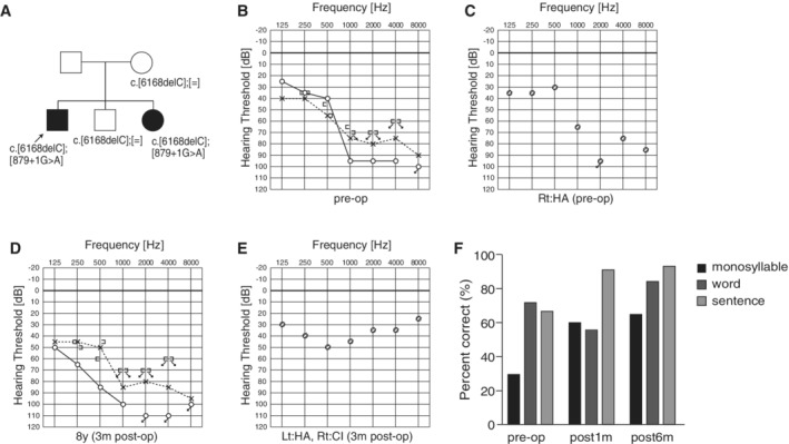 Figure 38