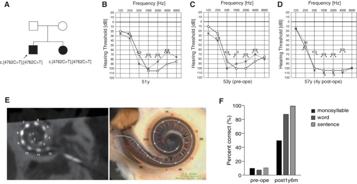 Figure 22