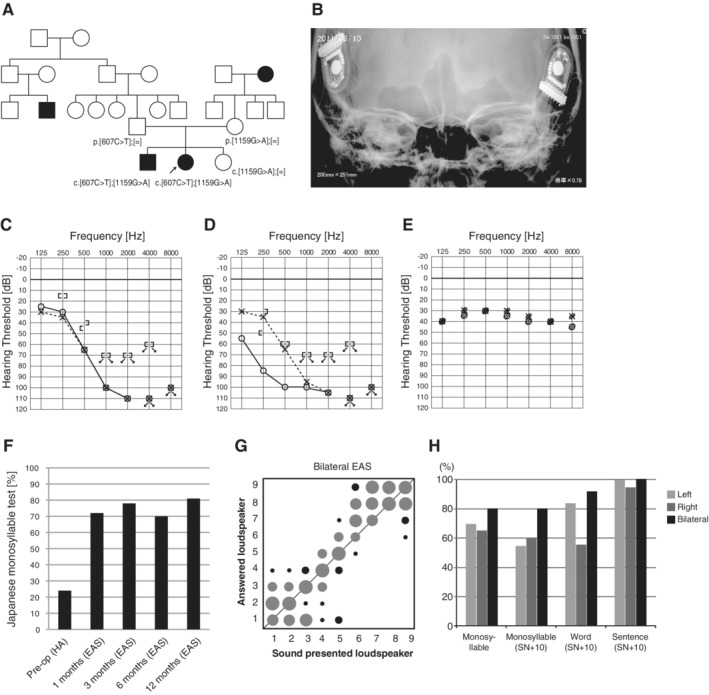 Figure 31