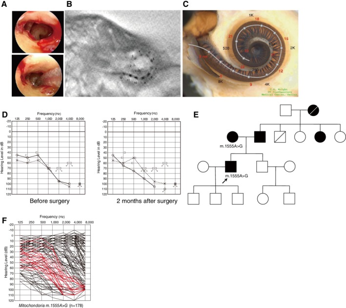 Figure 32