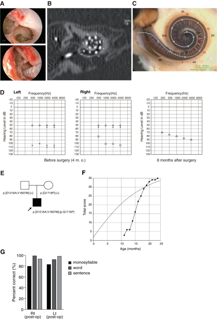 Figure 20