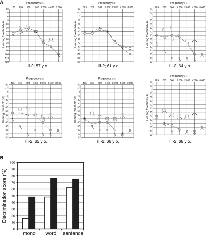 Figure 41