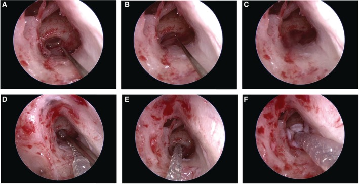 Figure 15