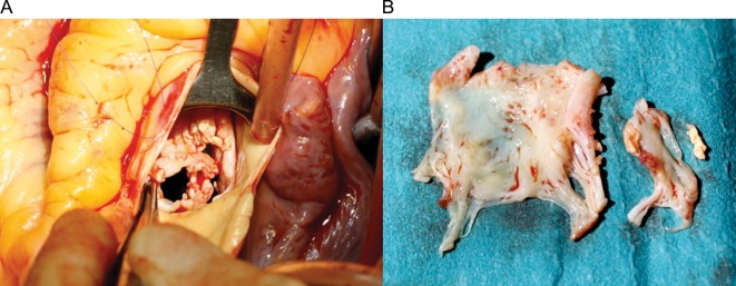 Figure 1: