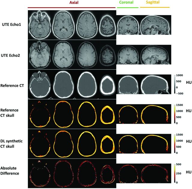 FIG 2.