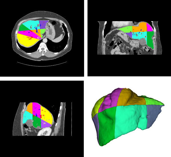 Figure 14