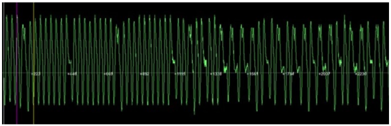 Figure 22