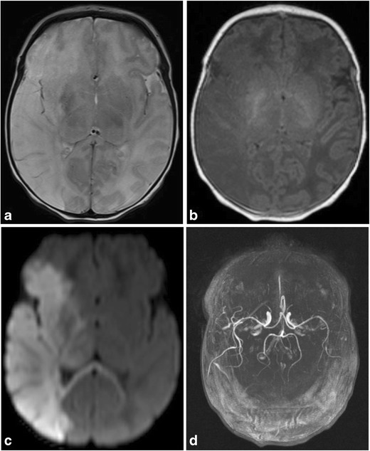 Fig. 11