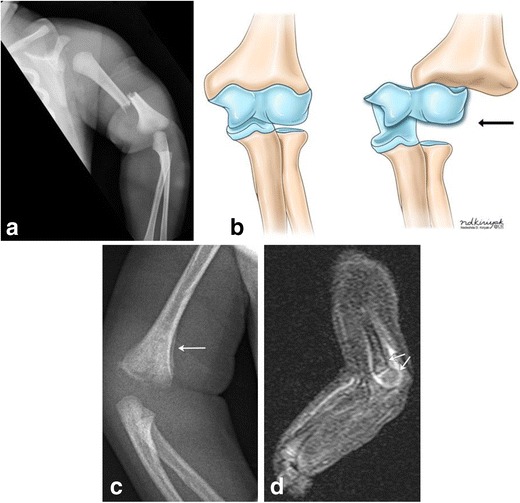 Fig. 17