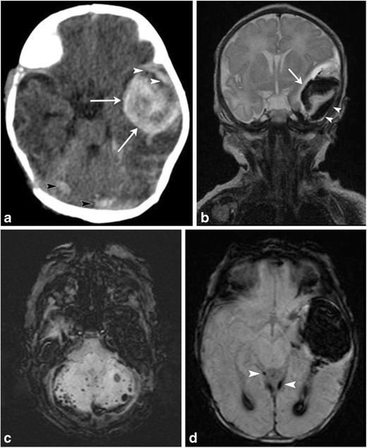 Fig. 10