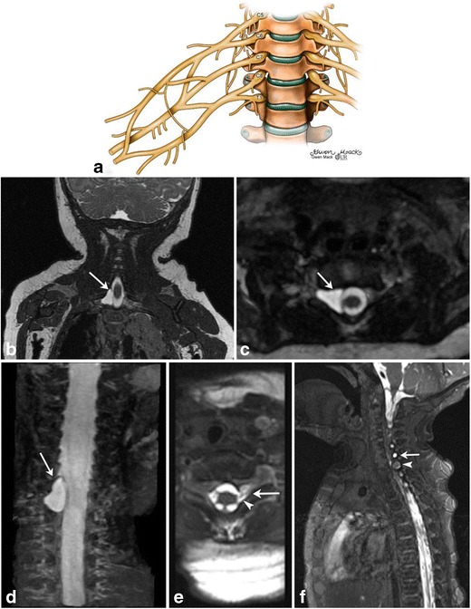 Fig. 13