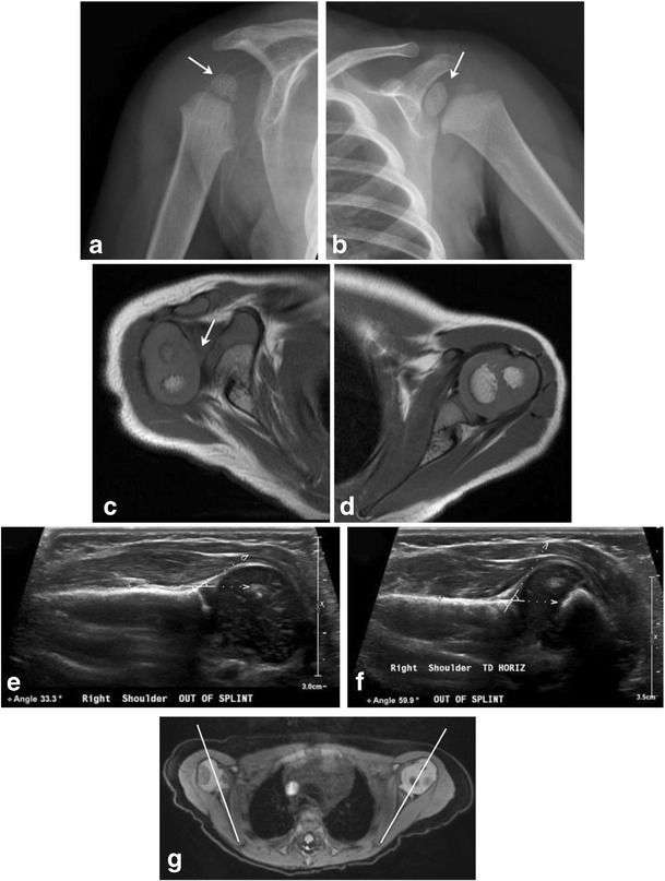 Fig. 14