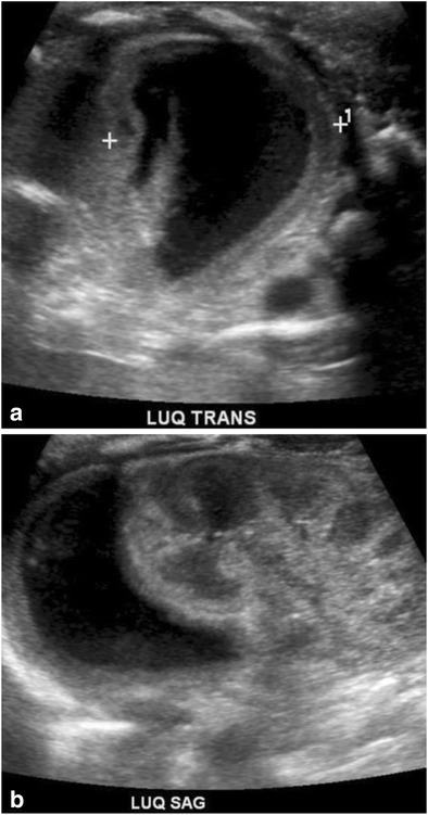 Fig. 20