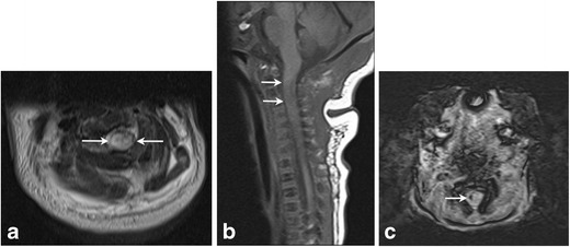 Fig. 12