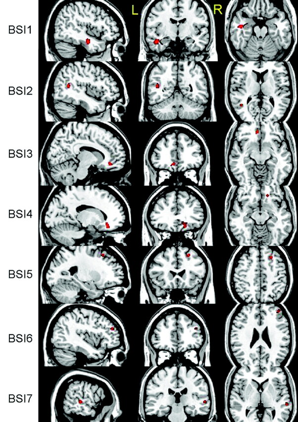 Fig 3.