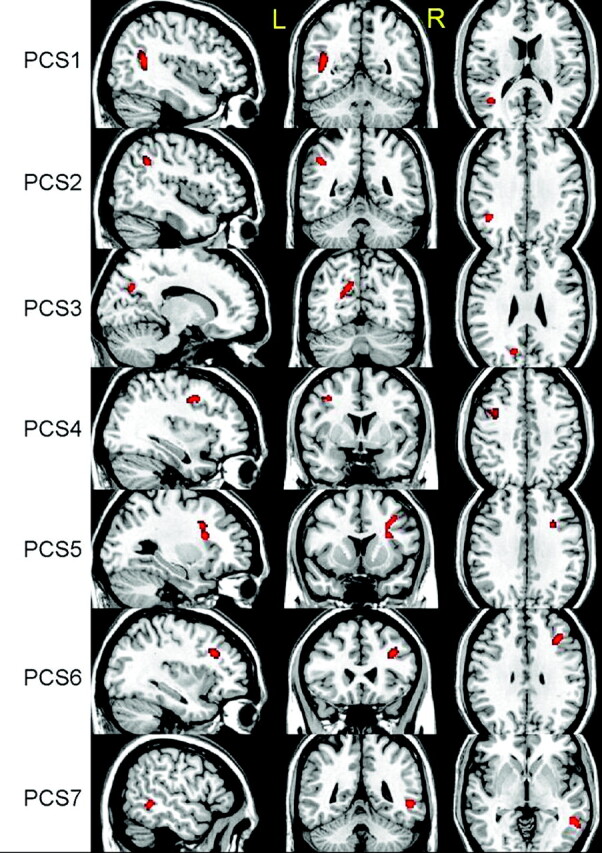 Fig 2.