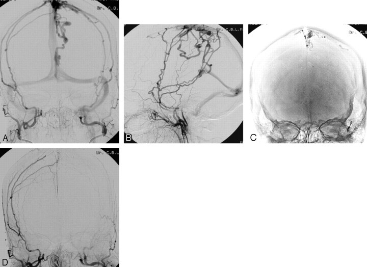 Fig 3.