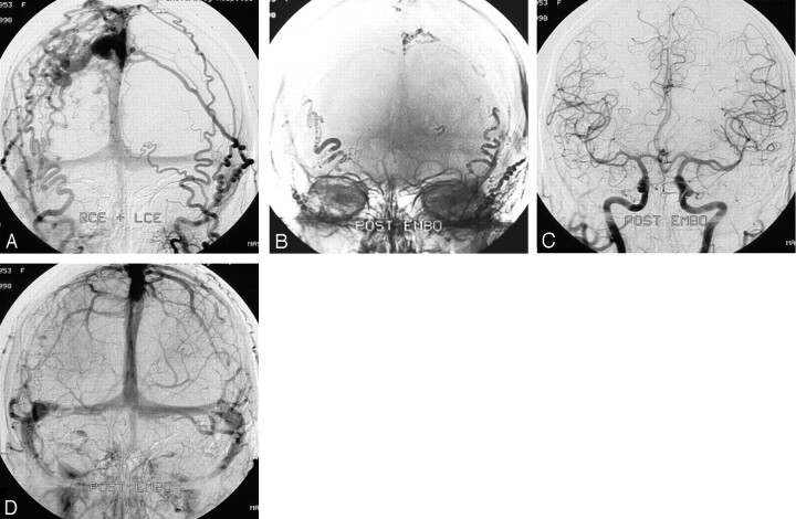 Fig 2.