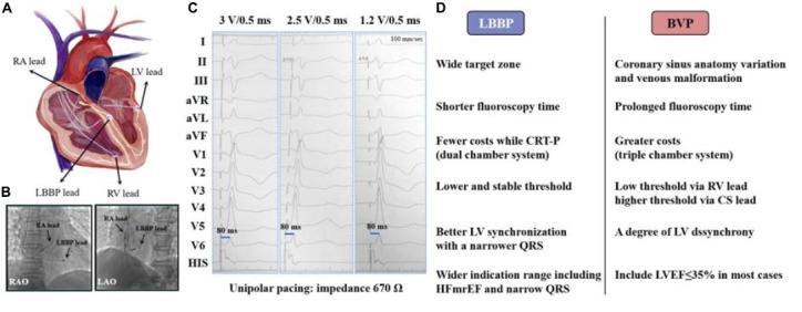 graphic file with name fcvm-09-901046-g000.jpg