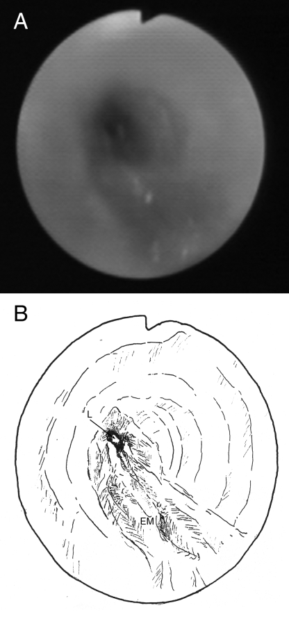 Figure 2)