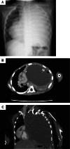 Fig. 1