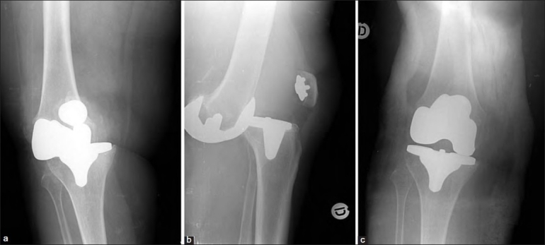 Figure 2a-c