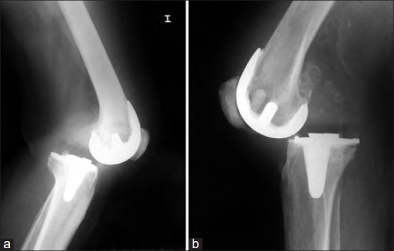 Figure 4a-b