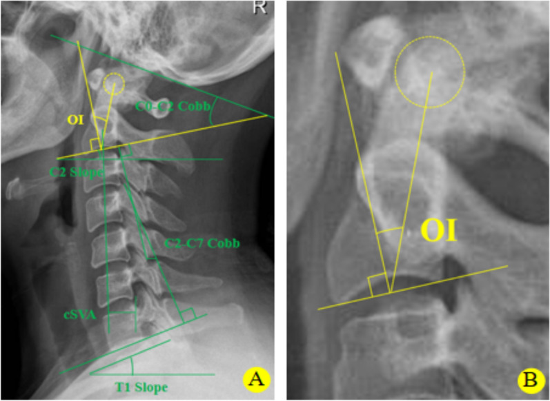 Fig. 1