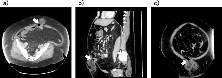 Fig. 2