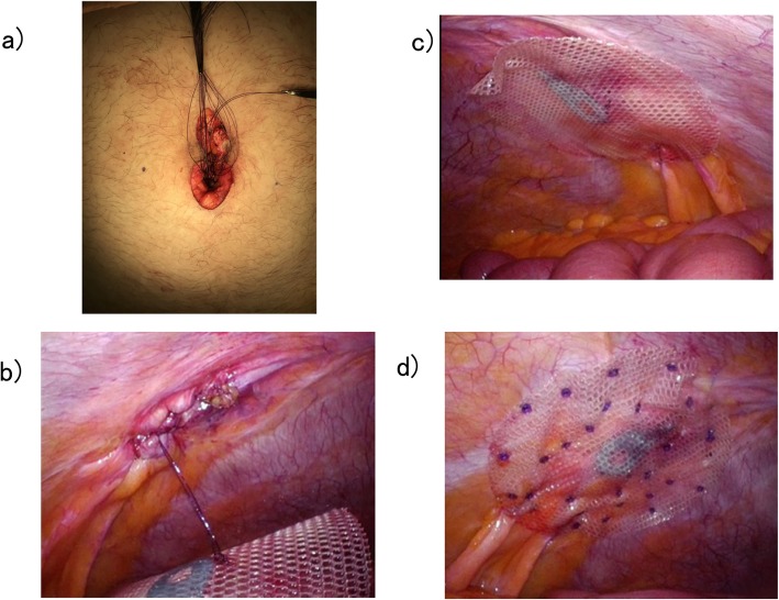 Fig. 4