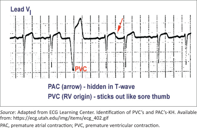 FIGURE 3