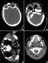 Fig. 1.