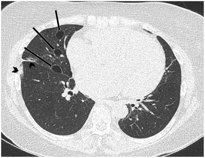 Fig. 13