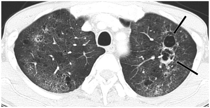 Fig. 11