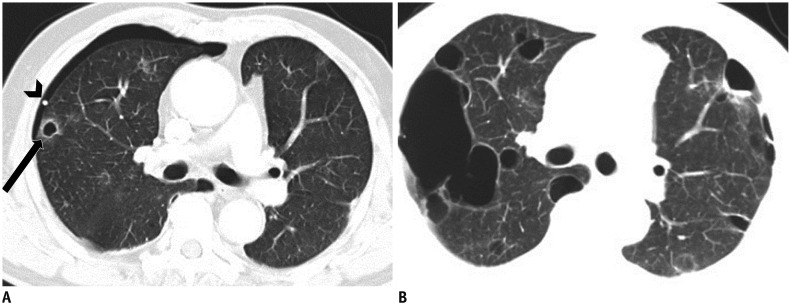 Fig. 10
