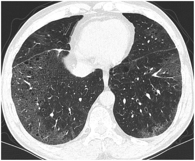 Fig. 12