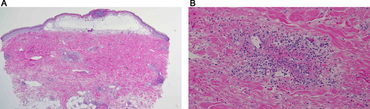 Fig 13