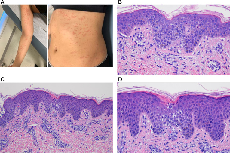 Fig 15