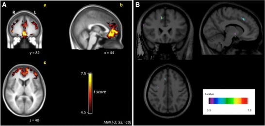 Fig. 4