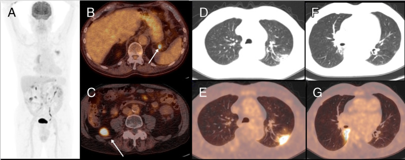 FIGURE 3