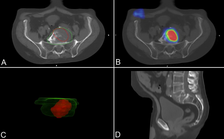 Figure 2