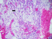 [Table/Fig-9]: